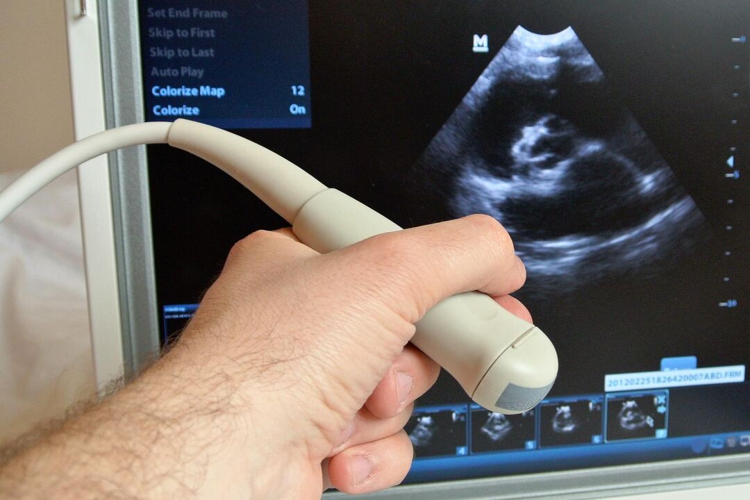 O ultrasonido axuda a diagnosticar a prostatite conxestiva nun home